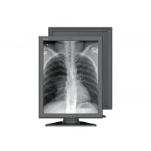 Медицинский монохромный монитор Jusha M260G фото