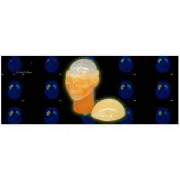 ПЭТ / ОФЭКТ Фантом головного мозга Ref. PH-64 PET/SPECT Brain Phantom фото 1