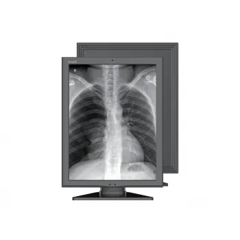 Медицинский монохромный монитор Jusha M260G фото 1