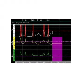 Дефектоскоп вихретоковый промышленный Вектор-60П фото 3